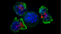 épissage cellules T cellule cancéreuse