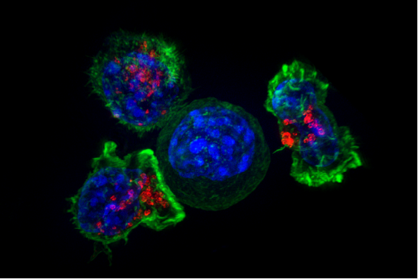 cellules T cellule thérapie anticancéreuse